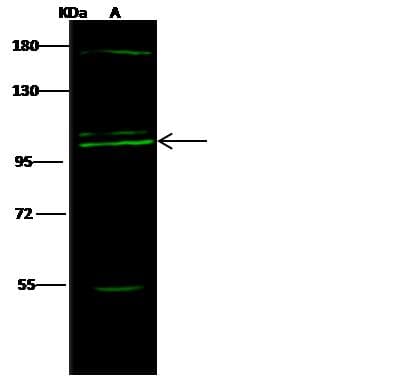 COPG / Gamma-COP Antibody (Preservative Free)