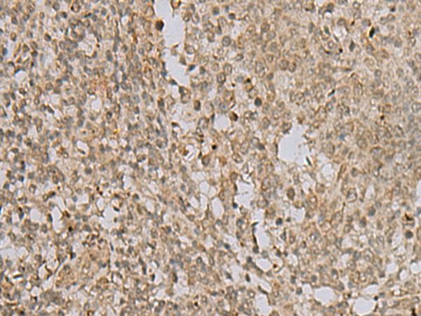 LYRM1 Antibody