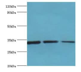 CCND3 / Cyclin D3 Antibody (aa1-292)