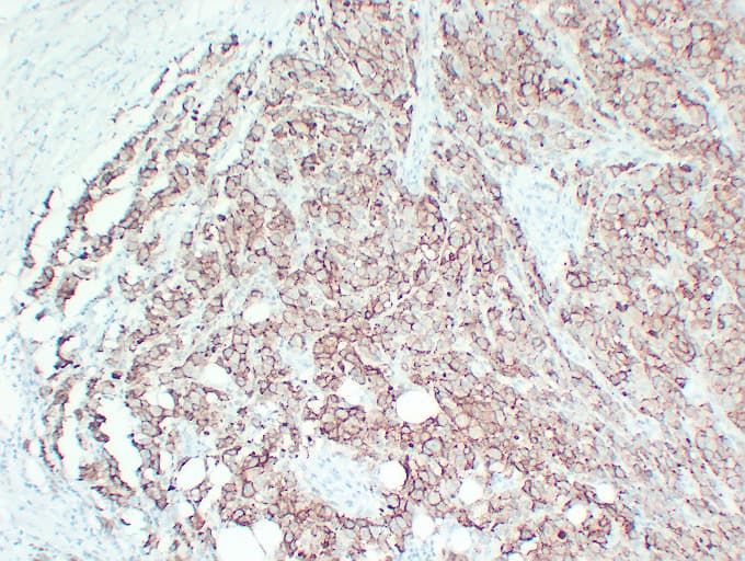CD63 Antibody (clone ABT-CD63)