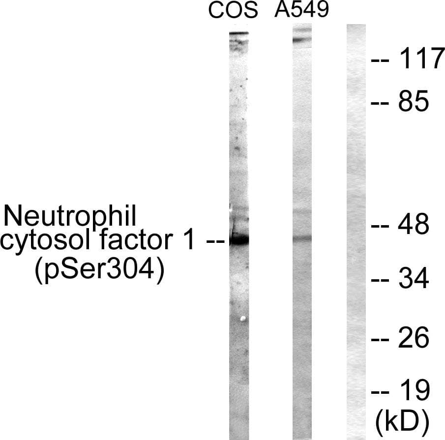 Polyclonal Rabbit anti-Human NCF1 / p47phox / p47 phox Antibody (phospho-Ser304, WB)