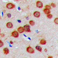 CDH23 / Cadherin 23 Antibody (aa86-125)