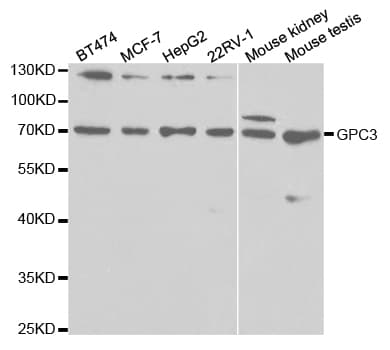 PathPlus™ Polyclonal Rabbit anti-Human GPC3 / Glypican 3 Antibody (IHC, WB)