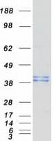 Human B3GAT3 Protein (Recombinant Myc-DDK (Flag))