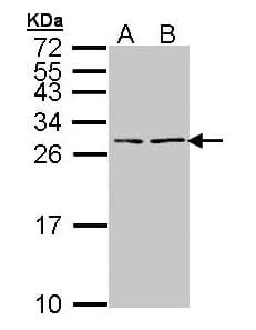 Polyclonal Rabbit anti-Human NPPB / BNP Antibody (aa1-134, WB)