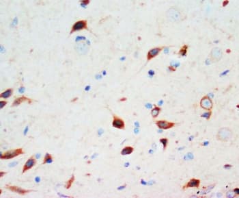 Polyclonal Rabbit anti-Human SCG3 / Secretogranin 3 Antibody (aa438-450, IHC, WB)