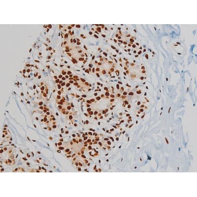 EZR / Ezrin Antibody (phospho-Tyr478)