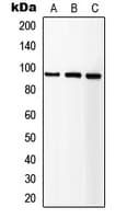 IGF1R / IGF1 Receptor Antibody (C-Terminus)