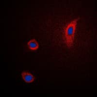 IHC-plus™ PTGS2 / COX2 / COX-2 Antibody (C-Terminus)