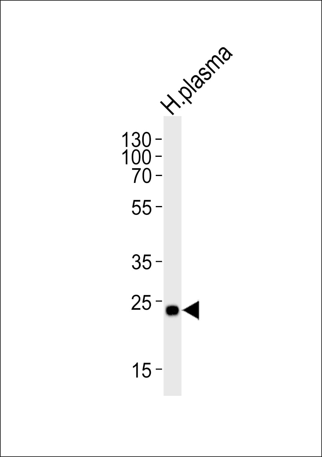 CFD / Factor D / Adipsin Antibody (aa68-99)