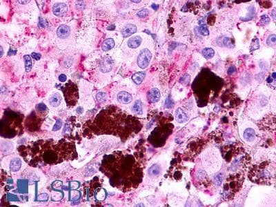 PathPlus™ Polyclonal Rabbit anti-Human MLNR/GPR38/Motilin Receptor Antibody (Cytoplasmic Domain, IHC)