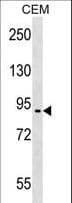 EPB41L4A Antibody (aa562-590)
