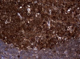 NME1 / NM23 Antibody (clone OTI7A1)