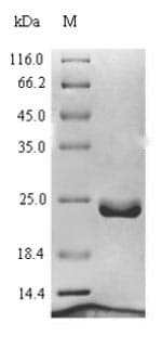 Human LAMTOR1 Protein (Recombinant 6His, N-terminus)