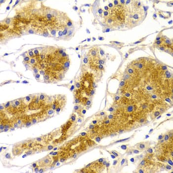 Polyclonal Rabbit anti-Human GHRH Antibody (IHC, WB)