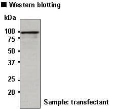 Polyclonal Rabbit GLB1 / Beta-Galactosidase Antibody (IHC, WB)