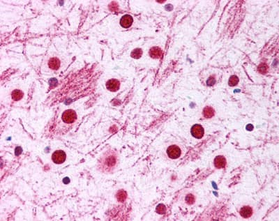 DISC1 Antibody (Biotin)