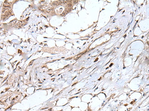 UBN1 / Ubinuclein 1 Antibody