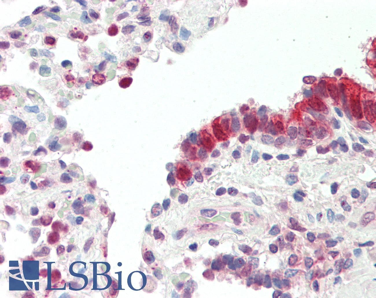 Polyclonal Rabbit anti-Human MXD4 Antibody (N-Terminus, IHC, WB)