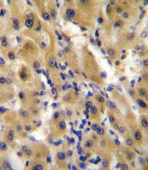 ENPP2 / Autotaxin Antibody (aa401-430)