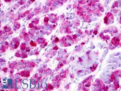 PathPlus™ Polyclonal Rabbit anti-Human LPAR5 / GPR92 Antibody (C-Terminus, IHC)
