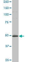 IHC-plus™ HTT / Huntingtin Antibody (clone 3F1)