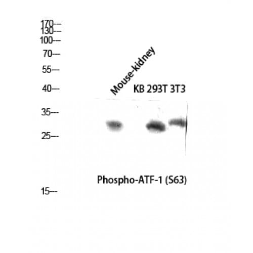 ATF1 Antibody (1-80 aa)