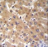 GAGE12B Antibody (aa21-49)