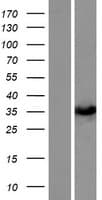 Human SULT1C3 / Sulfotransferase 1C3 Protein (Over-Expression Lysate Myc-DDK (Flag))