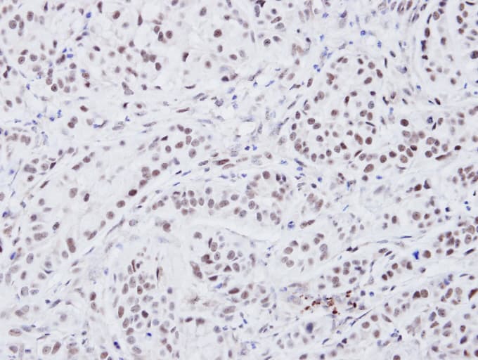 ATRX Antibody (aa2161-2443)