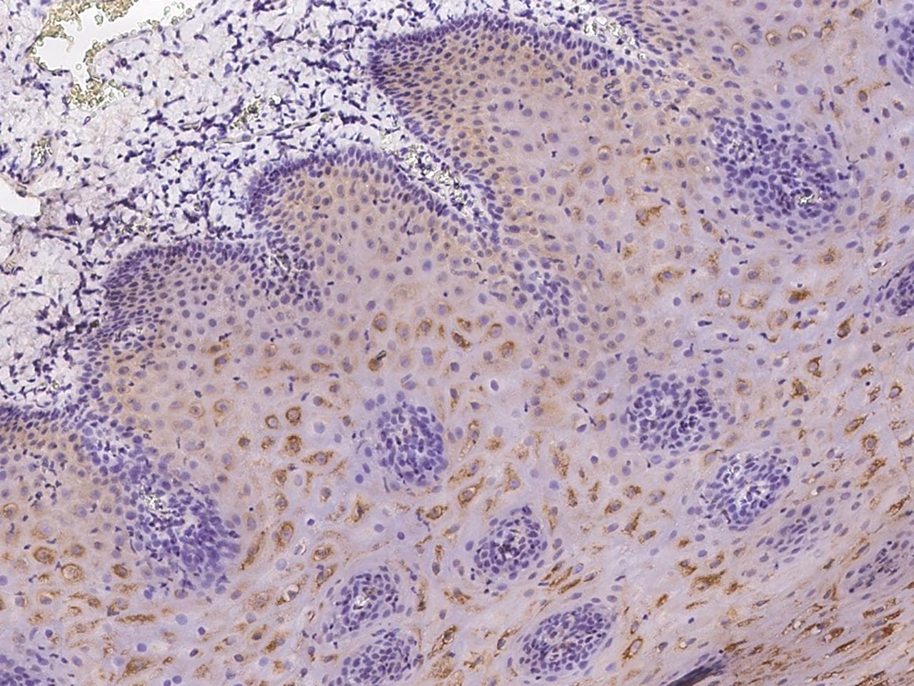 Polyclonal Rabbit anti-Human LRRC29 Antibody (IHC)