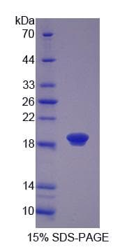 Human CLP / COTL1 Protein (Recombinant His-S)