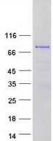 Human TGM7 / Transglutaminase 7 Protein (Recombinant Myc-DDK (Flag))