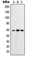 Polyclonal Rabbit anti-Human PRKCSH Antibody (Internal, IF, WB)