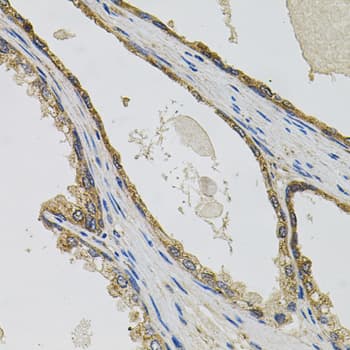 Polyclonal Rabbit anti-Human CCK4 / PTK7 Antibody (IHC, WB)