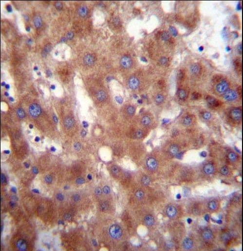 Polyclonal Rabbit anti-Human HSD17B4 Antibody (aa341-370, IHC, WB)