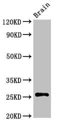 ASCL1 / MASH1 Antibody