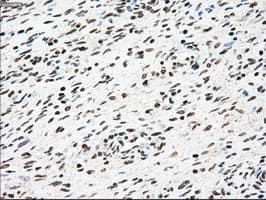 SSB / La Antibody (clone OTI2C8)