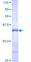 Human PLEC / Plectin Protein (Recombinant GST, N-terminus)
