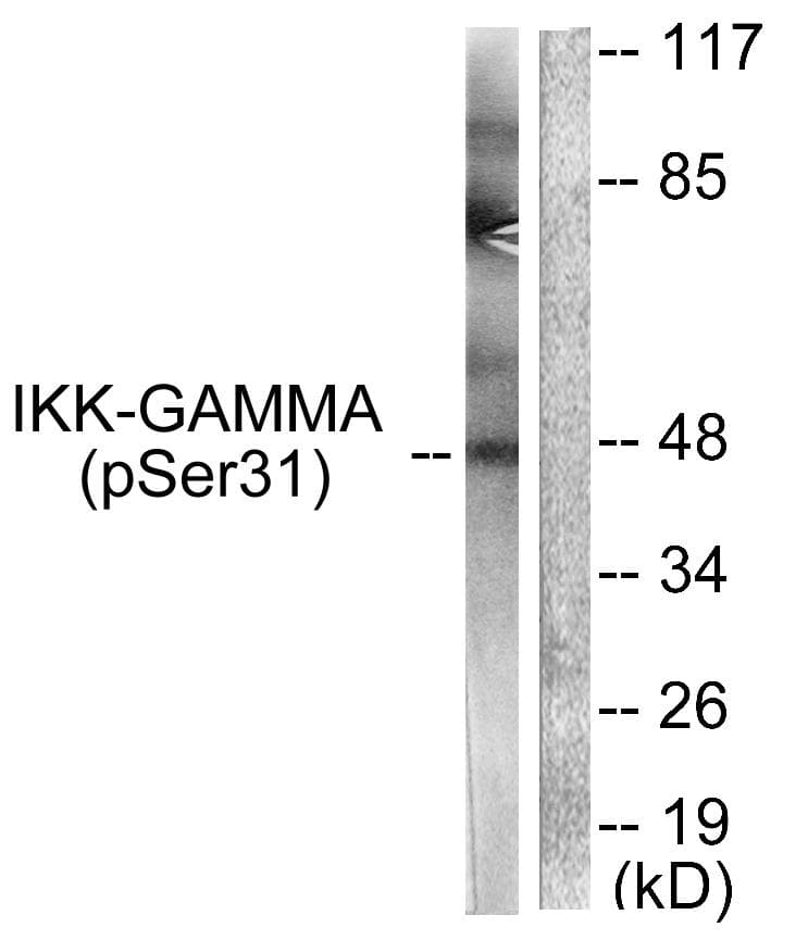 IKBKG / NEMO / IKK Gamma Antibody (phospho-Ser31)