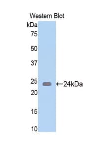 NAGA Antibody (aa218-415, PE)
