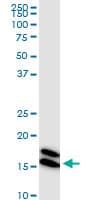 IHC-plus™ NME1 / NM23 Antibody (clone 1D7)