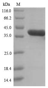 Mouse QPCT / QC Protein (Recombinant 6His, N-terminus)