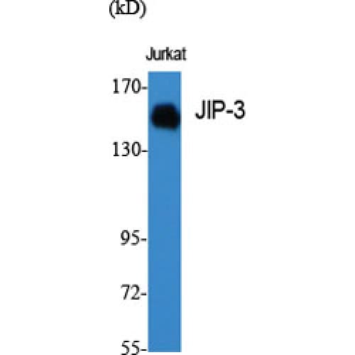 Polyclonal Rabbit anti-Human MAPK8IP3 / JIP3 Antibody (590-670 aa, Internal, IHC, IF, WB)