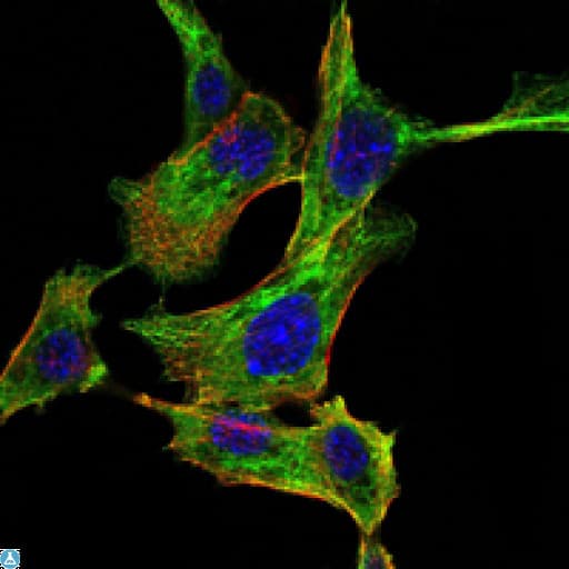 Monoclonal Mouse anti-Human CHUK / IKKA / IKK Alpha Antibody (IF, WB)