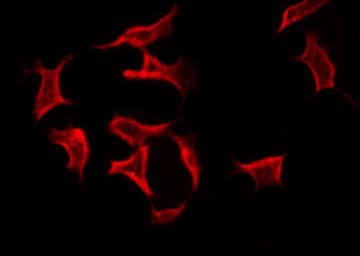 TNFAIP6 / TSG-6 Antibody