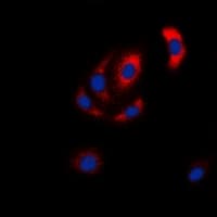 Polyclonal Rabbit anti-Human MAP2K6 / MEK6 / MKK6 Antibody (N-Terminus, IHC, IF, WB)