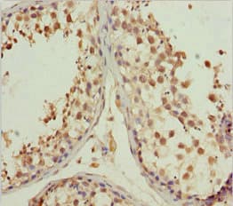Polyclonal Rabbit anti-Human L2HGDH Antibody (IHC)