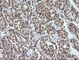 OTUB1 / OTU1 Antibody (clone OTI1E3)