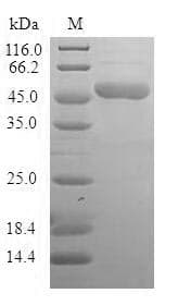 Human BAG2 Protein (Recombinant GST, N-terminus)